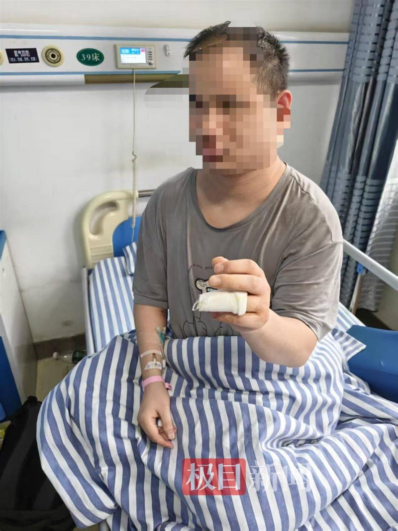 众汇到底是个正规平台吗？你不可不知的保养隐患揭秘